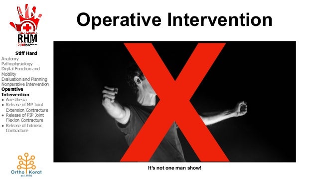 Stiff Intervention